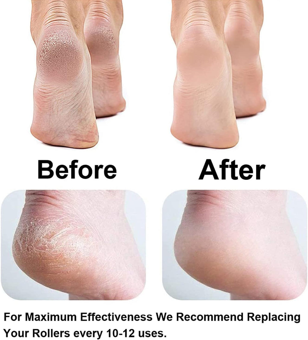 Callus Remover Rechargeable Pedicure Tool for Dead Skin