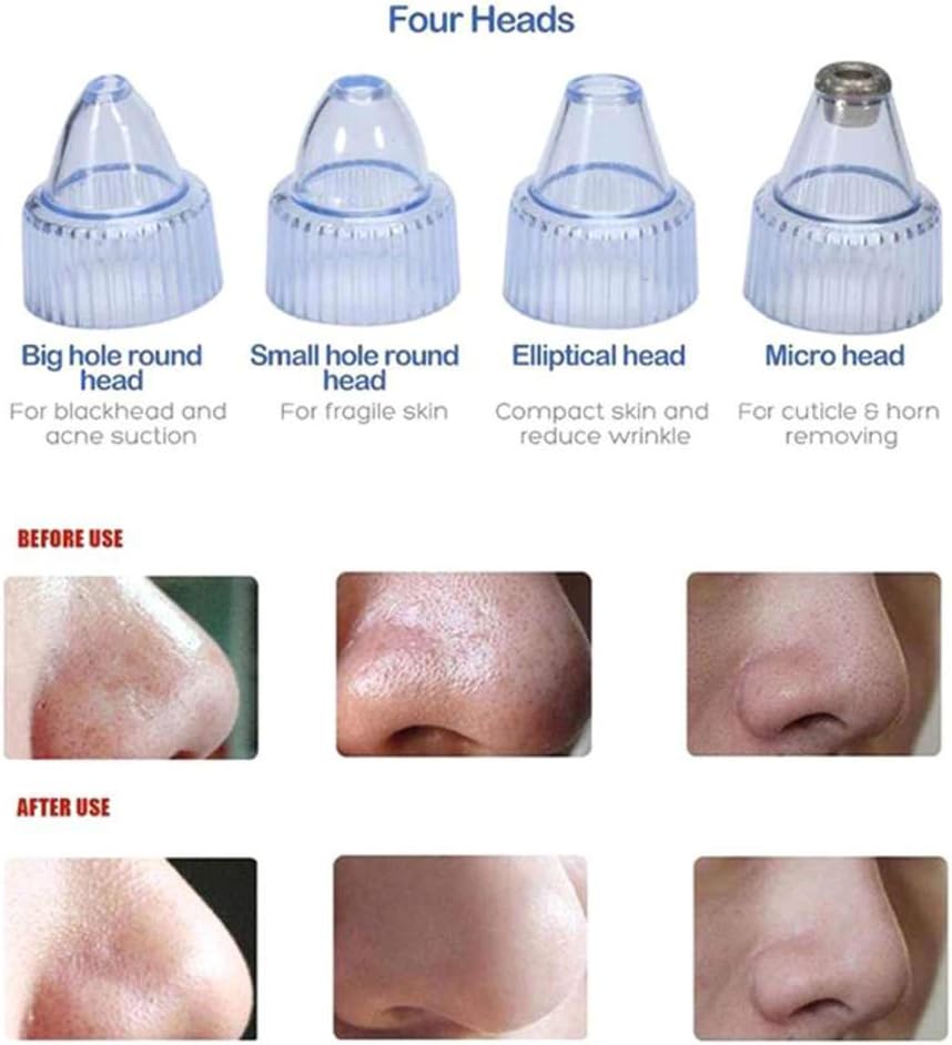 Blackhead Remover Cleansing Tool